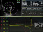 Swing Dynamics